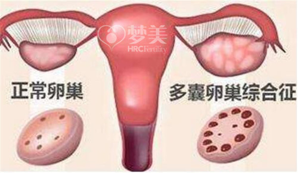 QQ截图20170930104043.jpg
