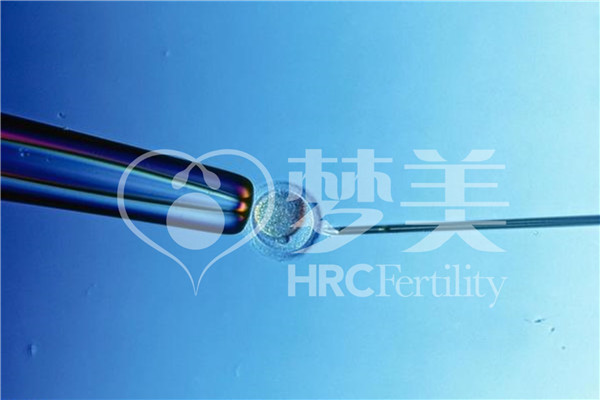 美国试管ICSI