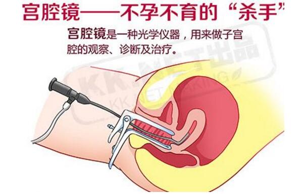 宫腔镜.jpg