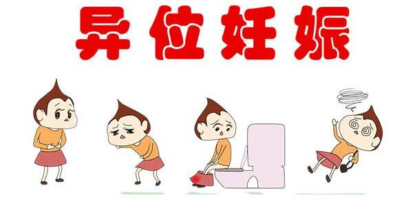 异位妊振3.jpg