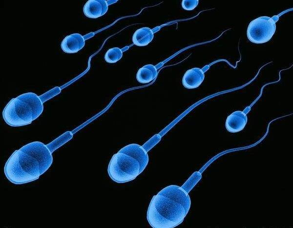 精子10.jpg