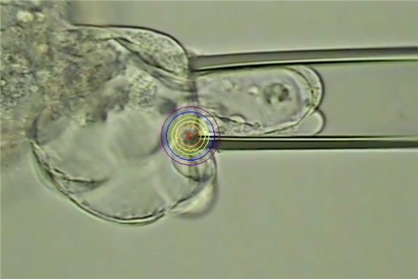 细胞提取-囊胚.jpg