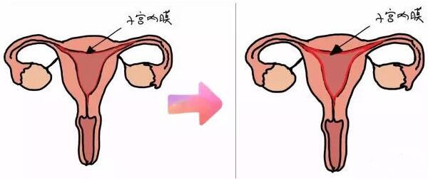 子宫内膜