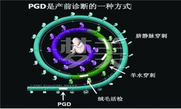 美国试管婴儿PGD