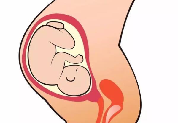 子宫孕宝