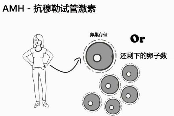 女性AMH检测