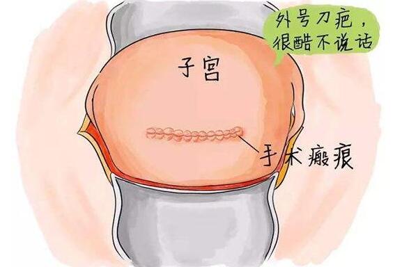 手术