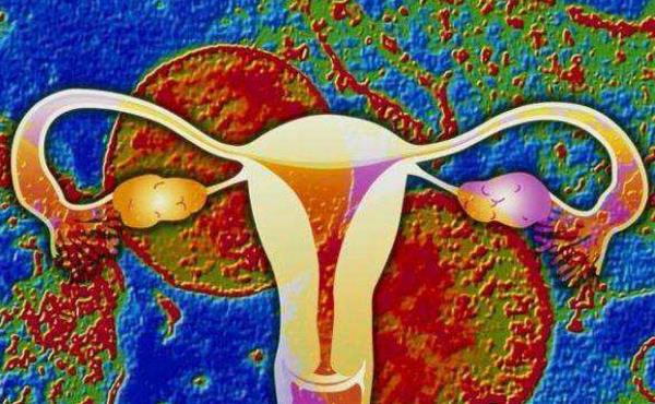 子宫内膜结核