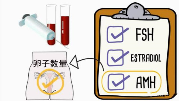 检查报告