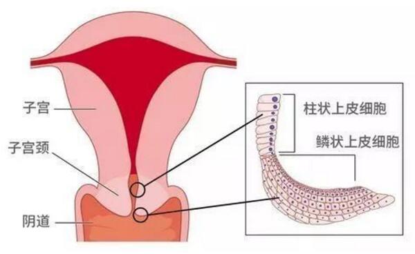 宫颈