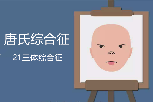 唐氏综合征