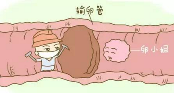 输卵管不通手术