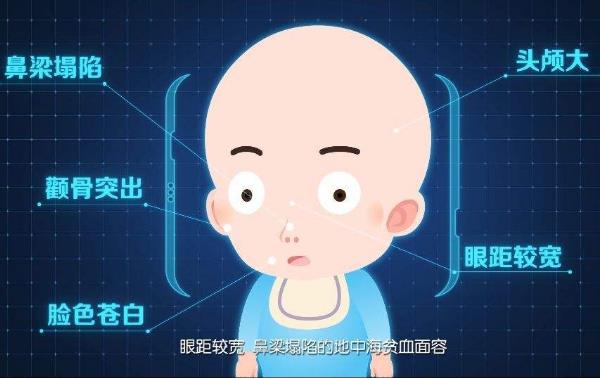 地中海贫血症
