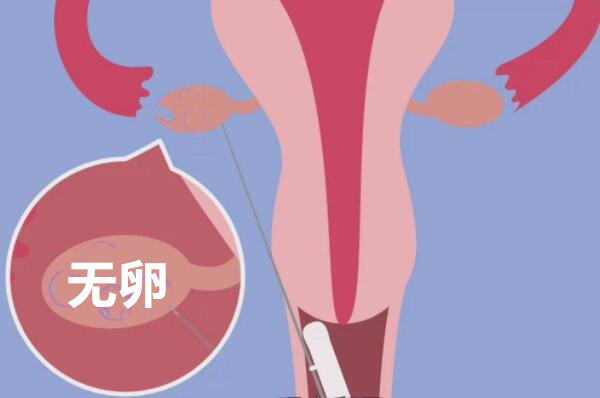 取不到卵