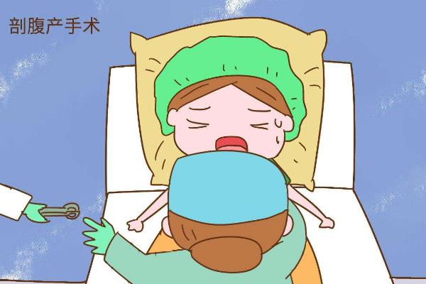 剖宫产技术
