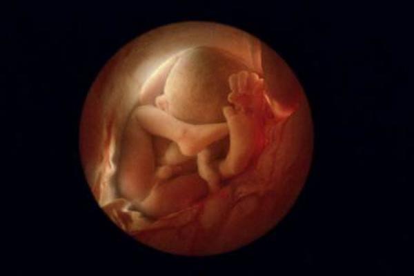 宫内胎儿