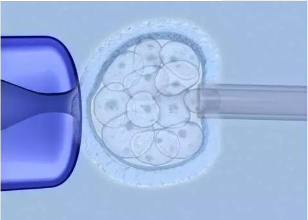 囊胚切片检查