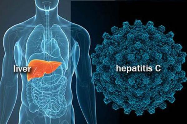 hepatitis c