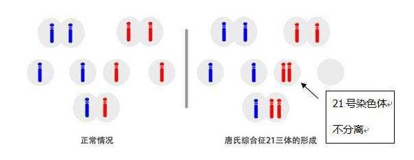 21号染色体