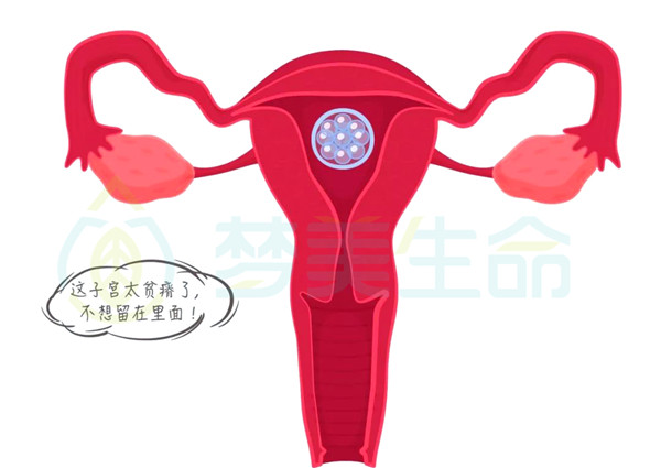 子宫