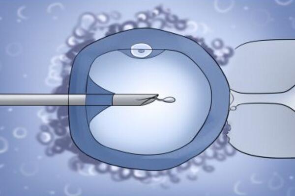单精子注射技术