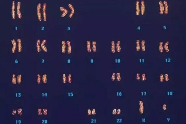 23对染色体