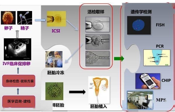 美国试管流程