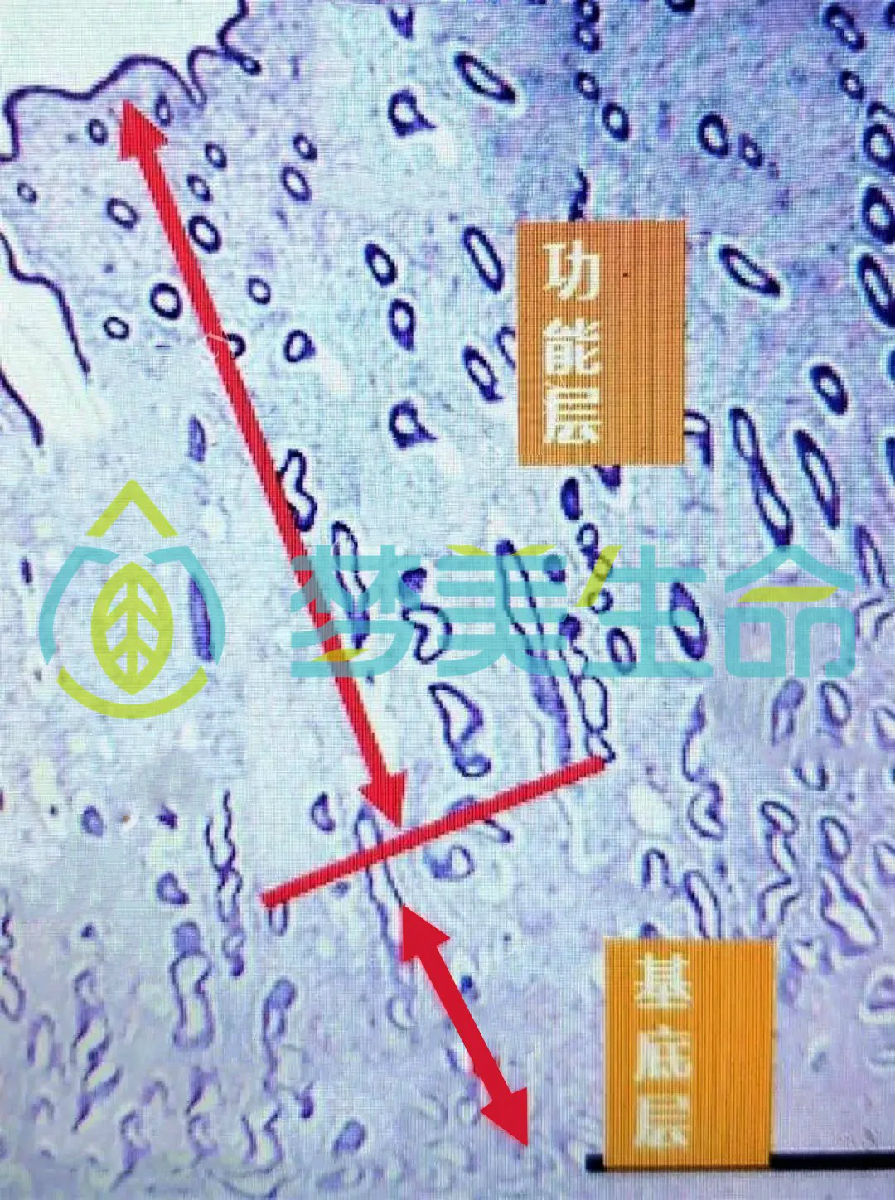子宫内膜.jpg
