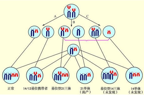 染色体异位