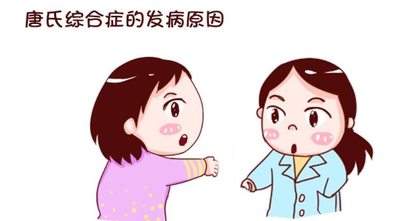 唐氏综合征