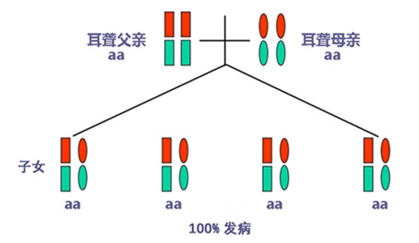 耳聋基因