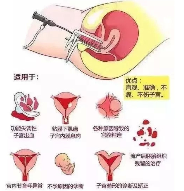 宫腔镜检查
