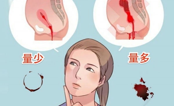 月经异常