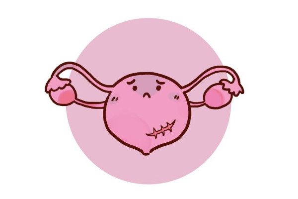 瘢痕子宫