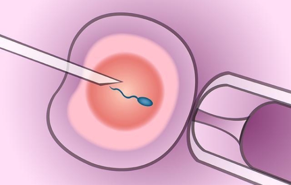 美国试管婴儿专家提醒：赴美IVF前远离辐射、提高精卵质量