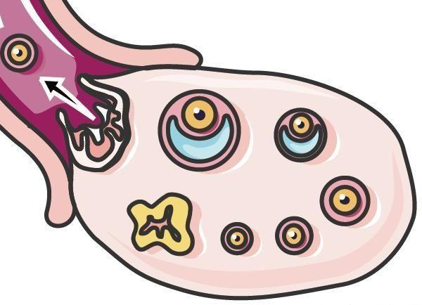 促排方案