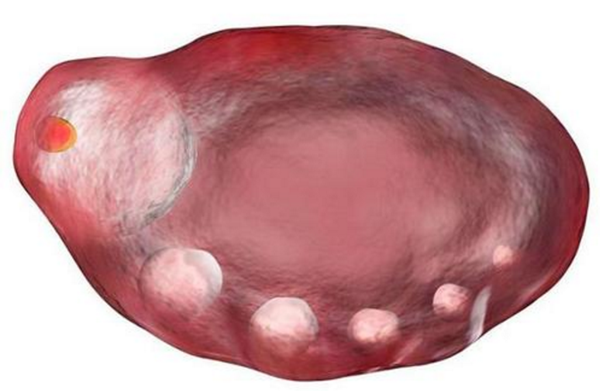 大龄女性卵泡卵泡
