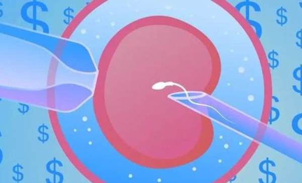 精子畸形去美国做试管，可以顺利完成IVF周期吗？