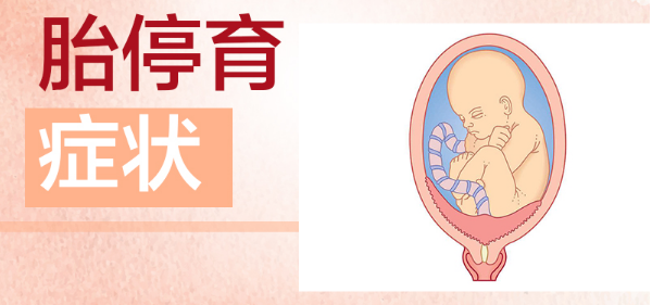 胎停育的症状