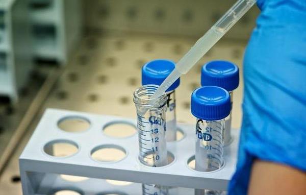 男性精子洗涤技术