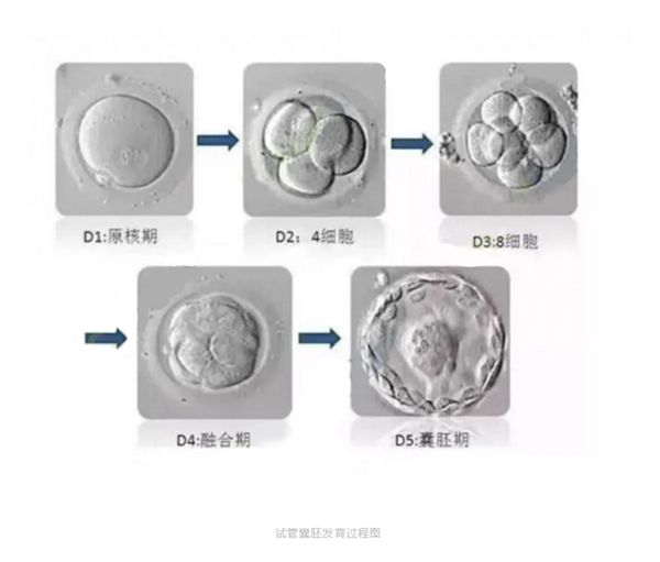胚胎移植