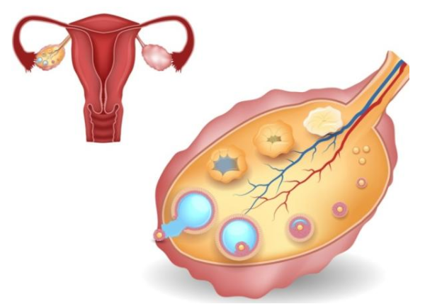 女性卵巢养护