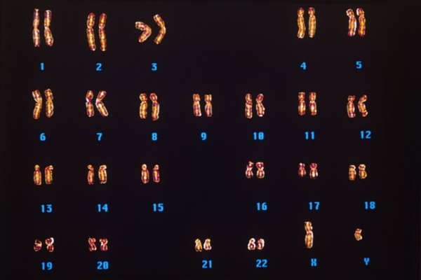 23对染色体