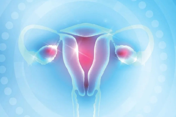 女性宫腔积液