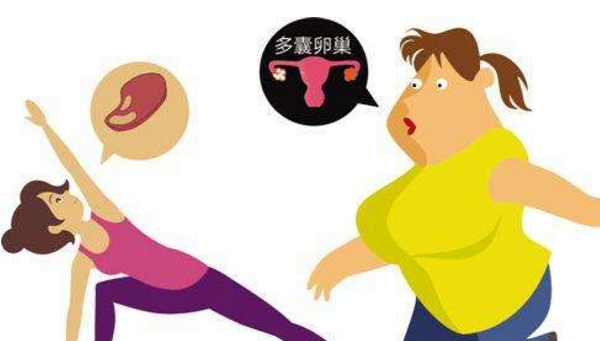 肥胖不孕