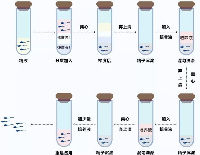 男性精子洗涤技术