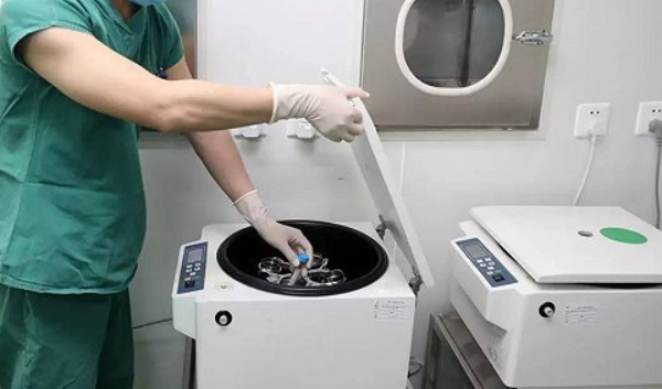精子洗涤技术