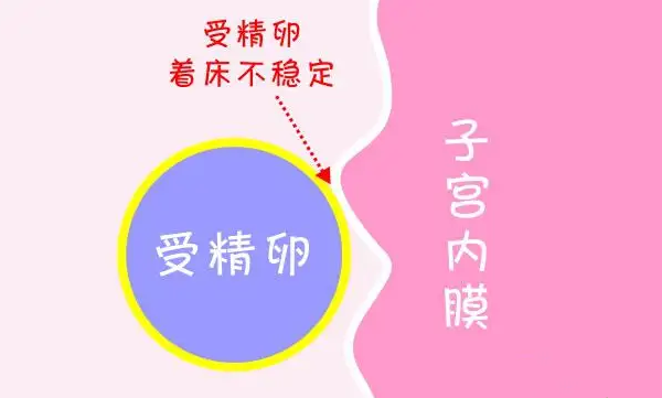 胚胎不着床