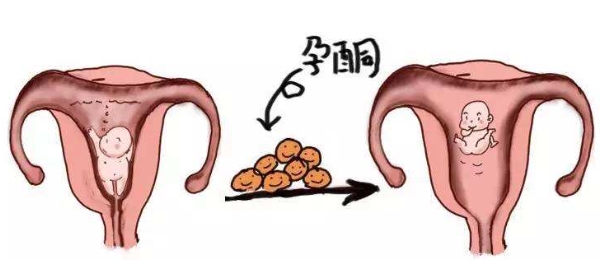 孕酮