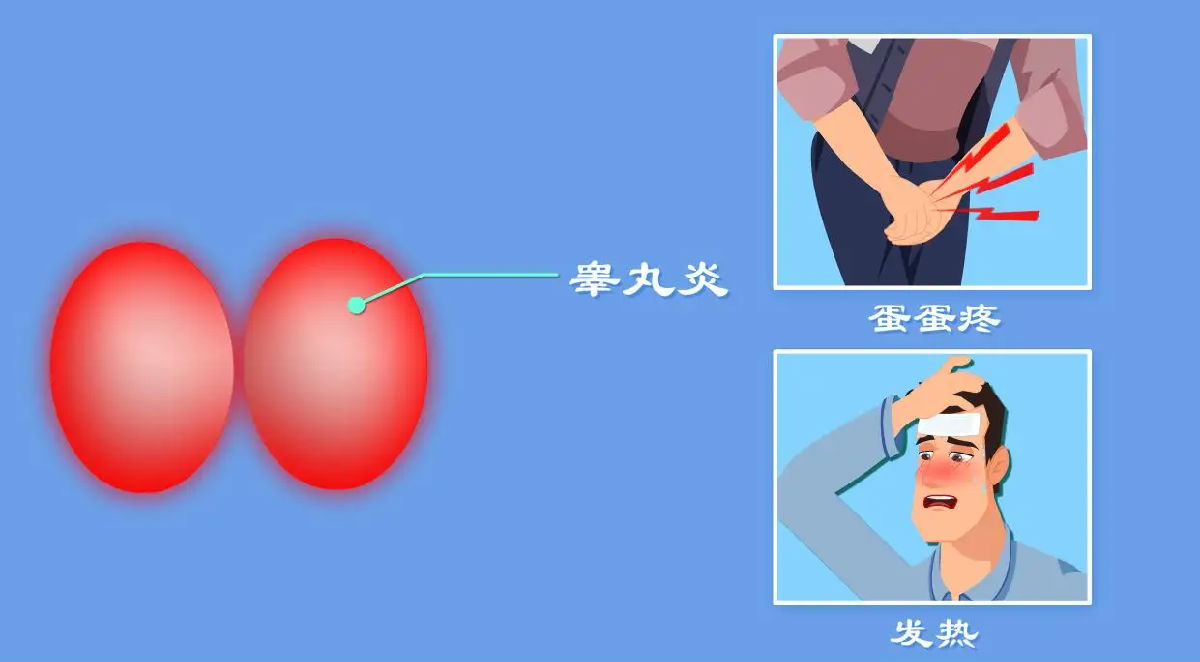 病毒性睾丸炎